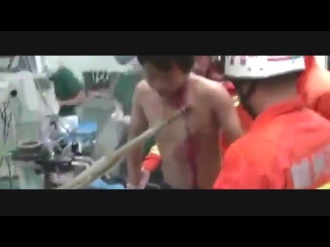 بالفيديو لقطات مروعة لعصا تخترق جسد شاب