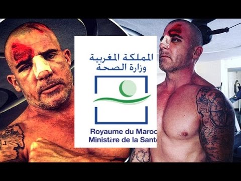 وزارة الصحة ترد على تصريحات الممثل الأميركي بورسيل