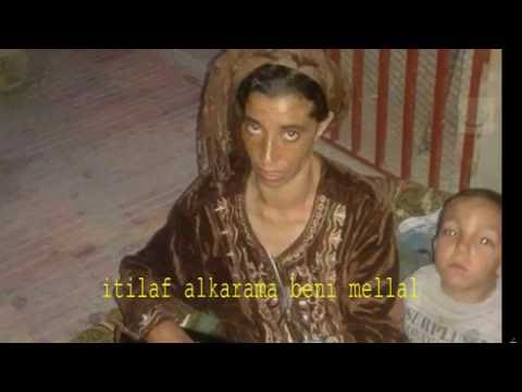 بالفيديو مأساة عزيزة وبلال في المستشفى الجهوي في بني ملال