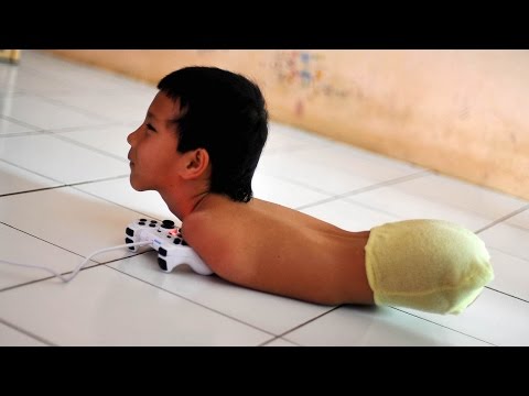 طفل بدون أطراف يتقن الكتابة ويحترف ألعاب الـبلاى ستيشن