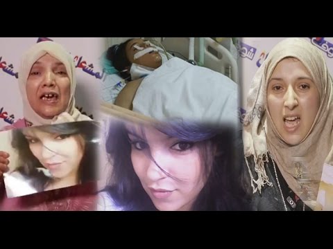 شاهد خطأ طبي يُحول حياة فتاة في ريعان شبابها إلى كابوس