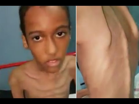 بالفيديو  أم تعذب ابنها وتحرمه من الطعام حتى تحول لهيكل عظمي