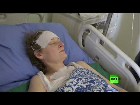 فيديو روسية فقدت ساقها ويدها في حلب تؤكد ان الأهم إنقاذ أطفالها