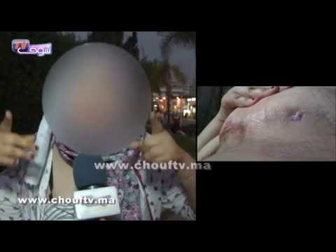 بالفيديو  شابة ضحية خطأ طبي تهدد بالانتحار بعد تشوه جسدها