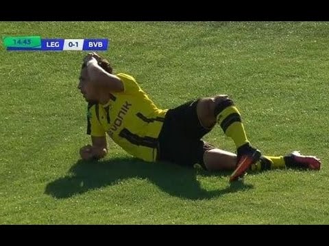 إصابة مروعة للاعب دورتموند الألماني للشباب