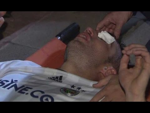 إصابة روبن فان بيرسي الخطيرة وإمكانية فقدانه للبصر