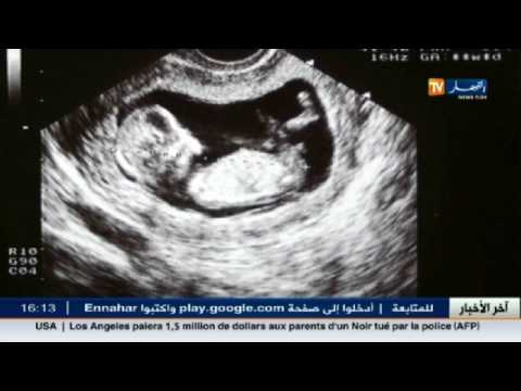 شاهد أضرار الأشعة فوق الصوتية للمرأة الحامل