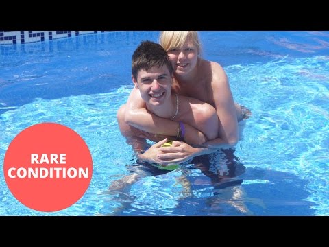 شاهد فتاة تنخلع مفاصلها يوميًا أكثر من 60 مرة