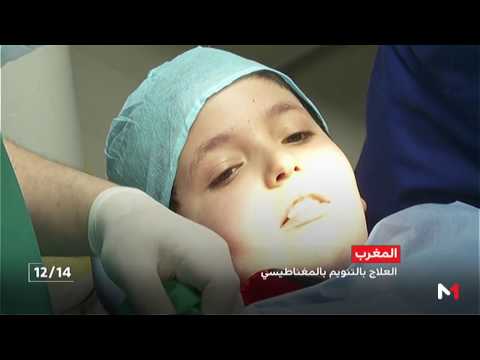 شاهد التنويم المغناطيسي طريقة حديثة يعتمد عليها الأطباء