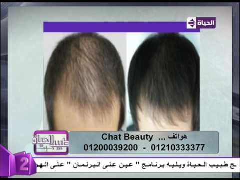 شاهد نتائج مبهرة بعد استخدام تقنية النانو