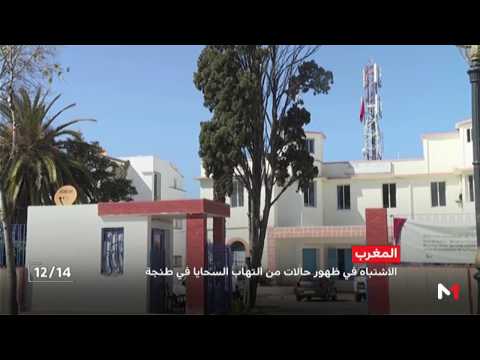 شاهد  الاشتباه في ظهور حالات التهاب السحايا في طنجة