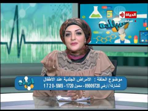 شاهد نصائح مهمة لتجنب مرض الجدري عند الأطفال