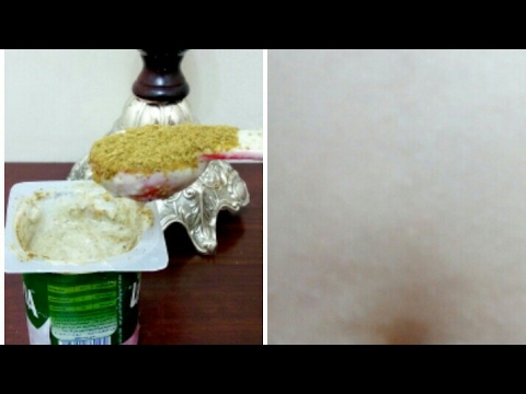 شاه ملعقة كبيرة تخلص من الكرش بدون تأثير على المعدة