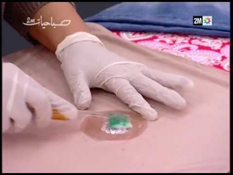 شاهد حيل للتخلص من البقع العالقة على الملابس