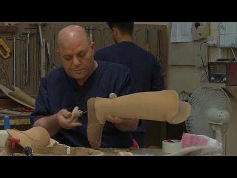 شاهد الصليب الأحمر يشرف على برنامج للأطراف الصناعية