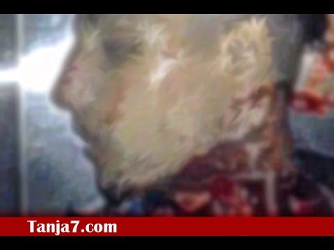 شاهد تصوير فيديوهات لجثث موتى في مستشفى محمد الخامس في طنجة وتسريبها