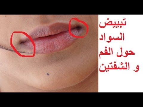 وصفة لعلاج السواد حول الفم