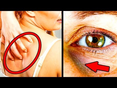 شاهد 10 علامات تدل على أنّ الشخص يأكل الكثير من السكر