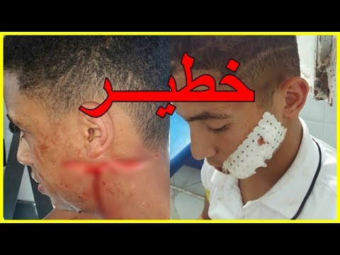 شاهد لاعب مغربي جديد يتعرض لهجوم بالأسلحة البيضاء