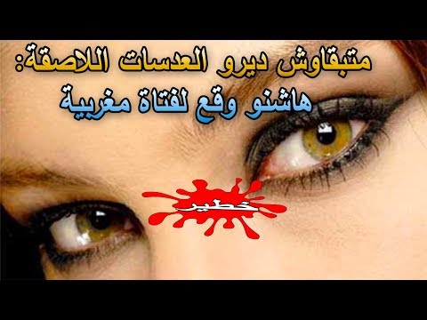 إصابة فتاة بمرض خطير في عينيها