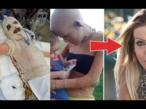 شاهد غيرة الفتيات أعمت إحداهن لتشوه الأخرى بشكل مروّعض