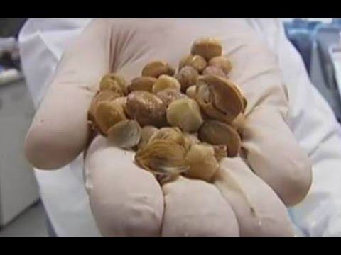 شاهد ثمار طبيعية تقتل مرض السرطان خلال 5 دقائق