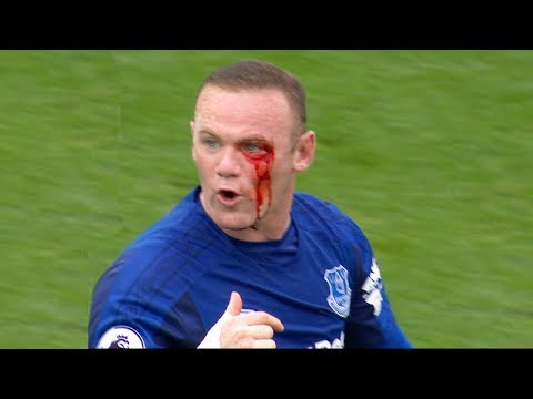 أقوى التدخلات والمضاربات الدموية في كرة القدم