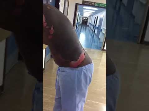 امرأة تشعل النار في زوجها لارتباطه بأخرى