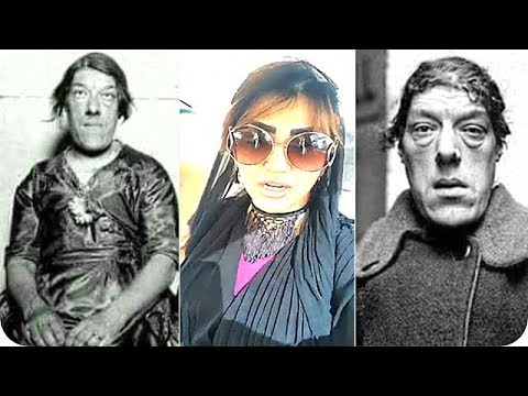 اميرة العباس وسالفة ابشع امرأة في العالم