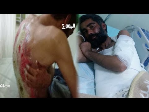 شاهد متشرّد مغربي يأكل الدود جسده