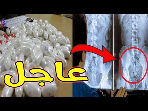 شاهد حجز 760 غرامًا من الكوكايين لدى برازيلية  والمفاجأة سنها 