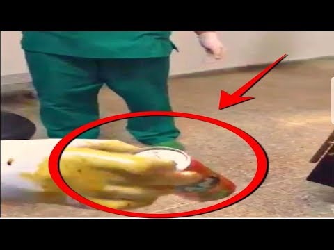 شاهد القصة الكاملة لاستخراج قنينة مشروب غازي من شاب في القنيطرة
