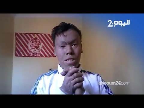 شاهد شاب قمري يستنجد بالملك محمد السادس