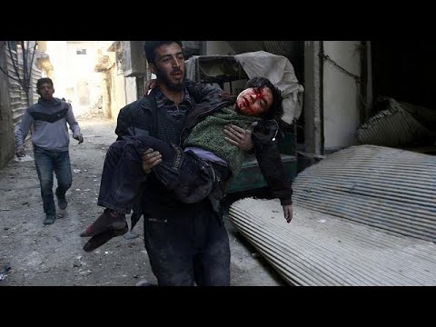 شاهد الكشف عن نسبة سوء التغذية في صفوف أطفال الغوطة في سورية