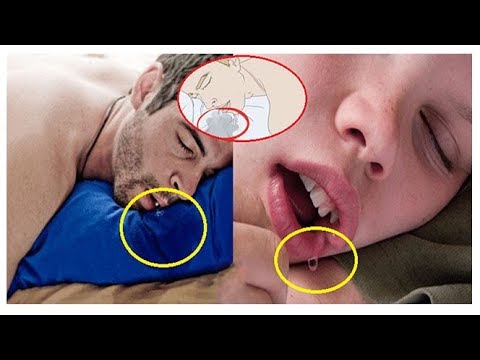 بال يديوأسباب سيلان اللعاب أثناء النوم