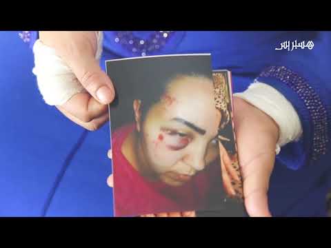 القصة الكاملة للزوجة التي شرملها زوجها في الشارع العام في الدشيرة