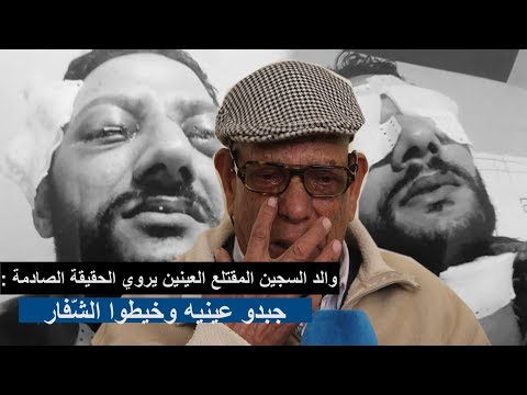 شاهد والد السجين المقتلع العينين يروي الحقيقة الصادمة