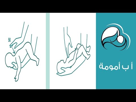 شاهد كيف تتعاملين مع الطفل الرضيع في حالات الاختناق