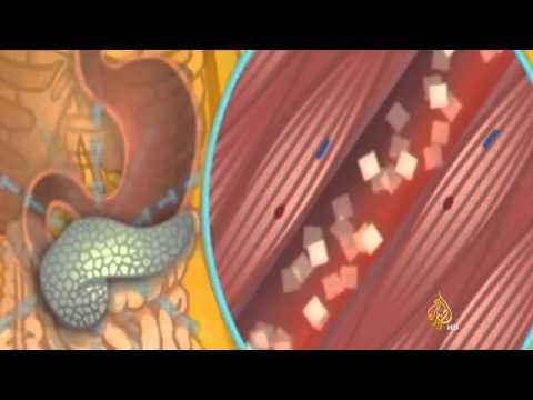 خلايا أساسيَّة لعلاج مرضى السكري