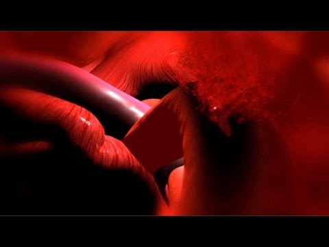 تعرف على مرض حمى الضنك