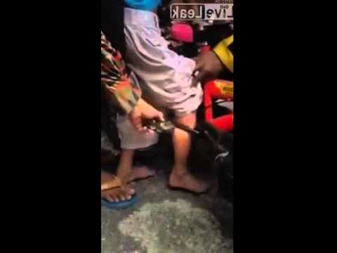 بالفيديو لحظة إنقاذ ساق طفل علقت في بدال دراجة