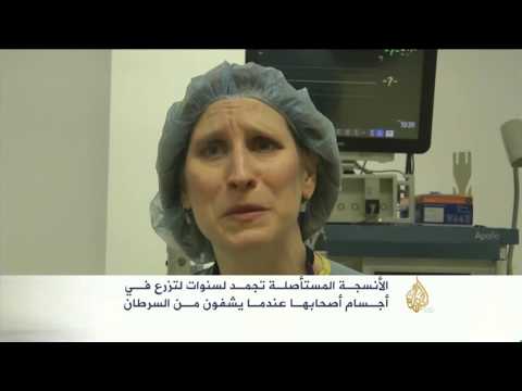 شاهد استئصال أنسجة سرطانية من أطفال لتمكينهم من الإنجاب