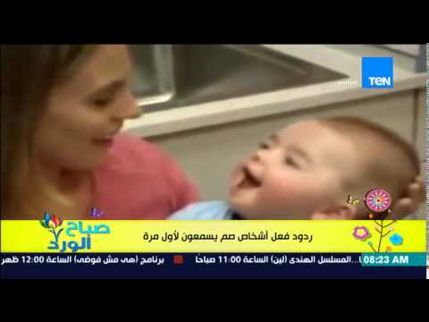 شاهد رصد ردود فعل أطفال صم يسمعون للمرة الأولى في حياتهم