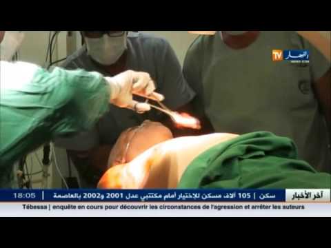 شاهد طبيب شاب ينقل خبرة زرع جهاز القلب إلى مستشفيات عين تيموشنت