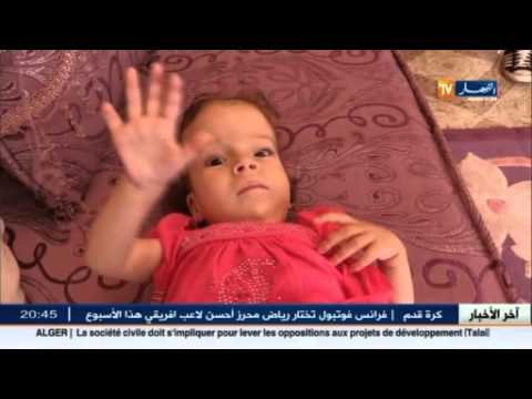 شاهد الطفلة لينا تمضي 15 شهرًا من المعاناة والتهميش