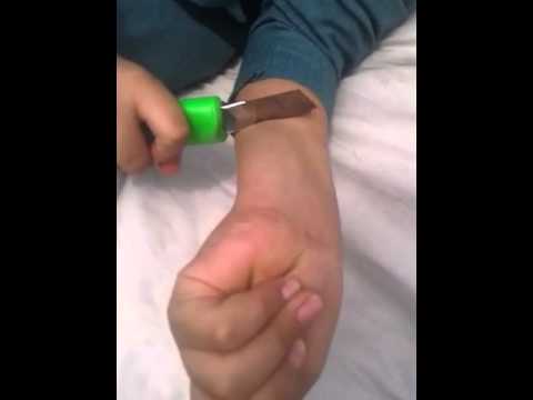 مزقت جلدها باستخدام سكين حاد