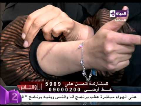 شاهد أثار تعذيب أسماء من زوجها بــ السكين