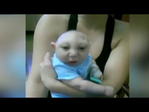 شاهد الطفل المعجزة يعيش عامًا كاملًا