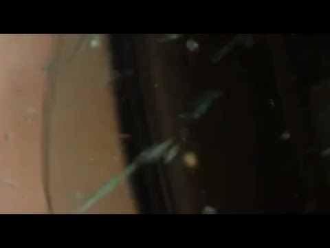 صاعقة رعدية تضرب شاب داخل سيارته