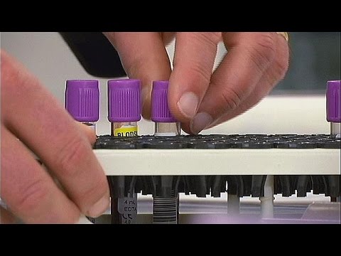 شاهد اختبار جديد للكشف المبكر عن سرطان البروستاتة